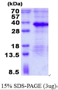 Human MAGP / MFAP2 Protein (Recombinant His)