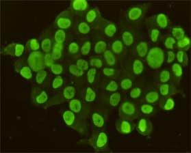 CDX2 Antibody