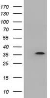 DNTTIP1 / TDIF1 Antibody (clone OTI4F7)