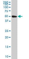 Monoclonal Mouse anti-Human ATL1 Antibody (clone 1B11, WB)