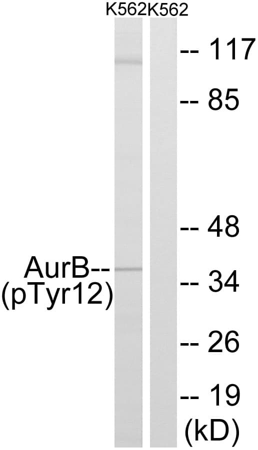 AURKB / Aurora-B Antibody (phospho-Tyr12)