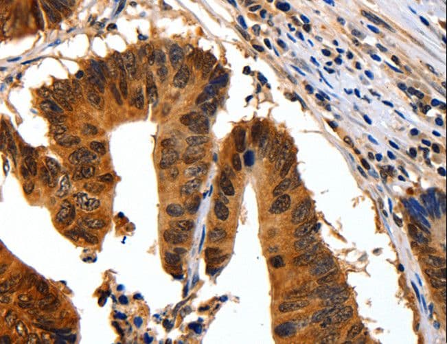 YWHAB / 14-3-3 Beta Antibody