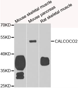 Polyclonal Rabbit anti-Human CALCOCO2 Antibody (IHC, WB)