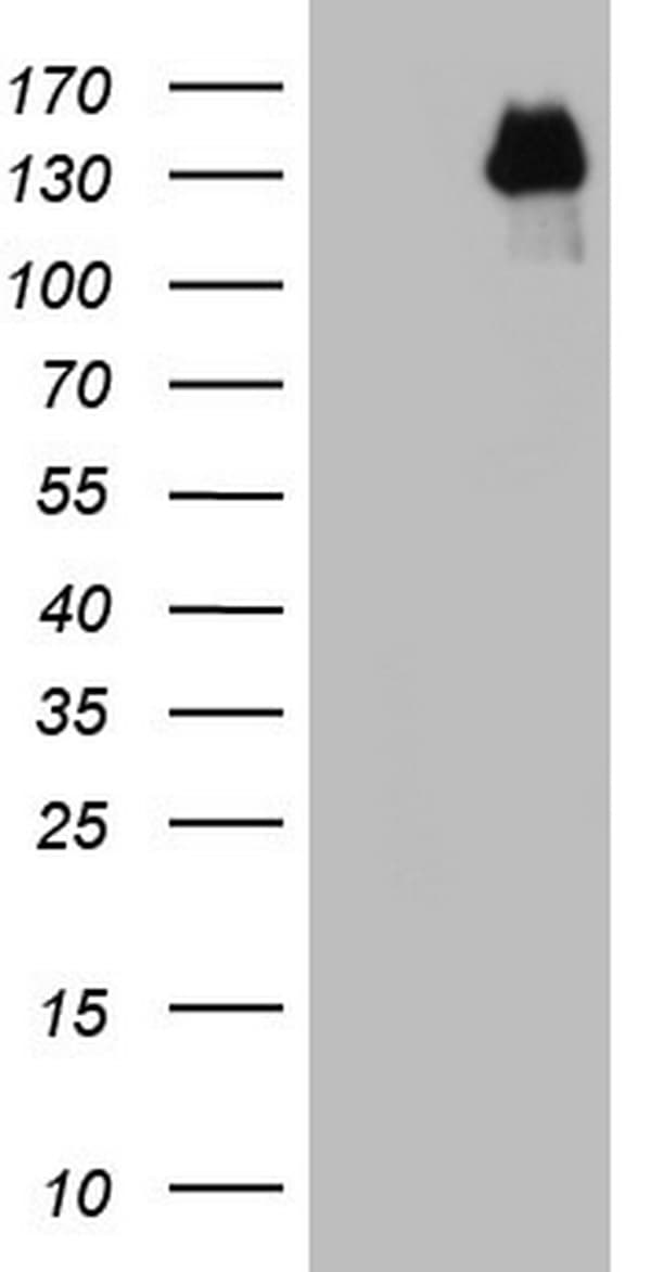 GLI / GLI1 Antibody (aa755-1106, clone OTI1E5)