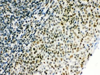 CTBP1 / CTBP Antibody