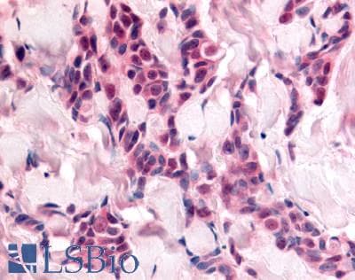 PathPlus™ Polyclonal Rabbit anti-Human CDK12 / CRKRS Antibody (Internal, IHC)