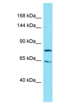 IGSF9B Antibody (aa266-315)