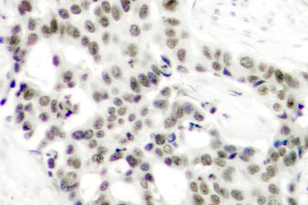 AR / Androgen Receptor Antibody (phospho-Ser650)