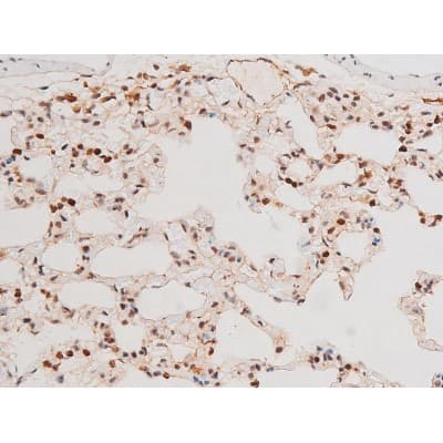 MAPK8 / JNK1 Antibody (phospho-Thr183,pTyr185)