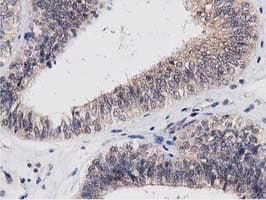 ACOT12 Antibody (clone OTI1A11)