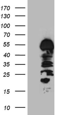 Monoclonal Mouse anti-Human HS1BP3 Antibody (clone OTI6C6, aa145-392, WB)