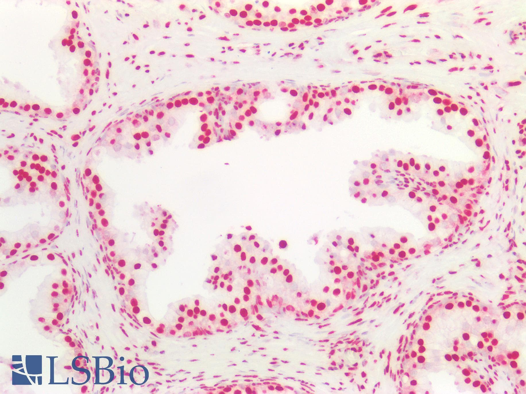 PathPlus™ HNRNPK / hnRNP K Antibody (aa1-50)