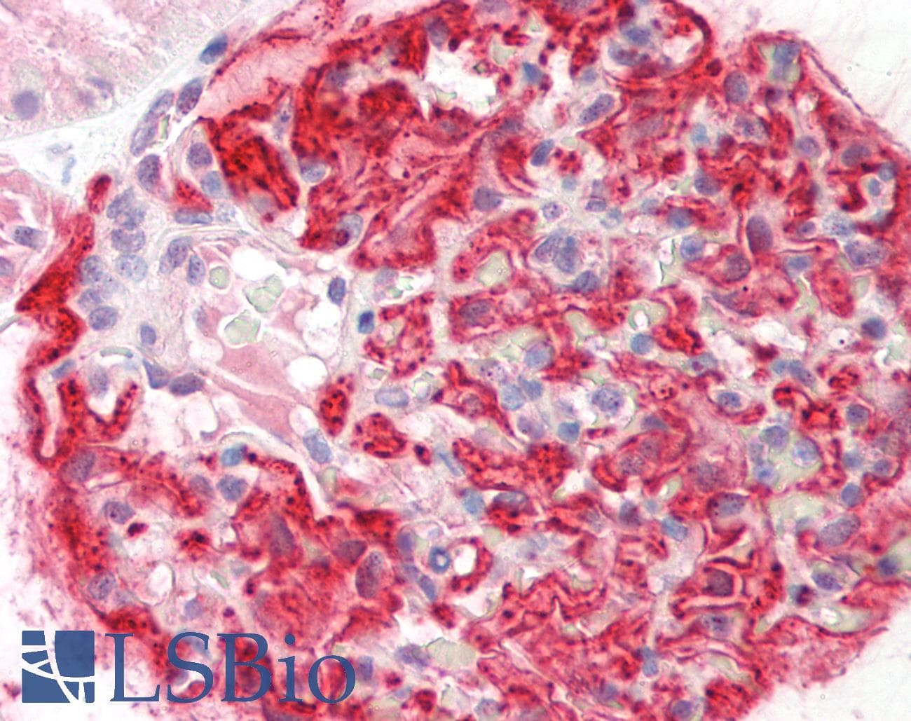 Polyclonal Rabbit anti-Human UGT1A5 Antibody (aa71-120, IHC, WB)