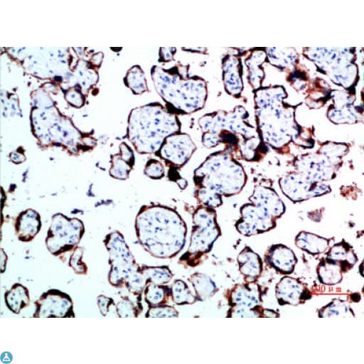 GH / Growth Hormone Antibody