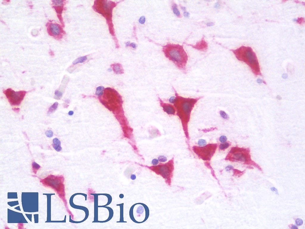 IHC-plus™ Polyclonal Rabbit anti-Human RPL28 / Ribosomal Protein L28 Antibody (aa41-90, IHC, WB)