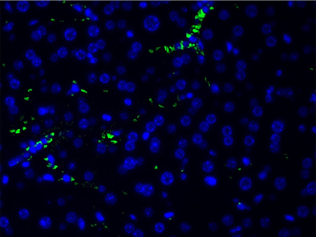 PIK3R1 / p85 Alpha Antibody (phospho-Tyr607)