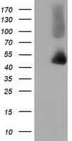 HP / Haptoglobin Antibody (clone OTI4C2)