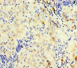 F7 / Factor VII Antibody