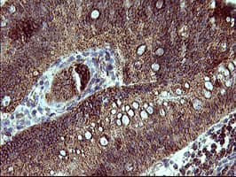 ACAA2 Antibody (clone OTI3H9)