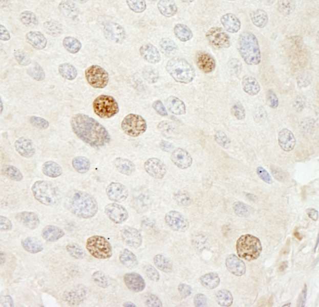 CDK2 Antibody (aa248-298)
