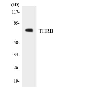 NR1A2 / THRB Antibody (aa378-427)