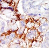 Polyclonal Rabbit anti-Human PAK3 Antibody (aa218-247, IHC, WB)