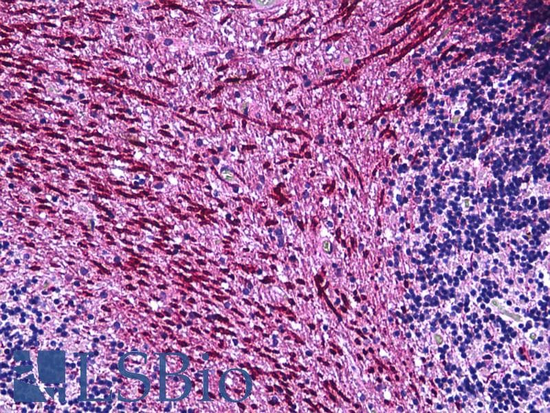 IHC-plus™ LPAR1 / LPA1 / EDG2 Antibody (aa5-54)