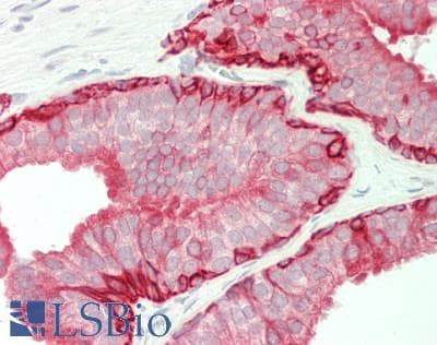 IHC-plus™ KRT5 / CK5 / Cytokeratin 5 Antibody (clone 4H8)
