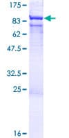 Human RNGTT / HCAP Protein (Recombinant GST)