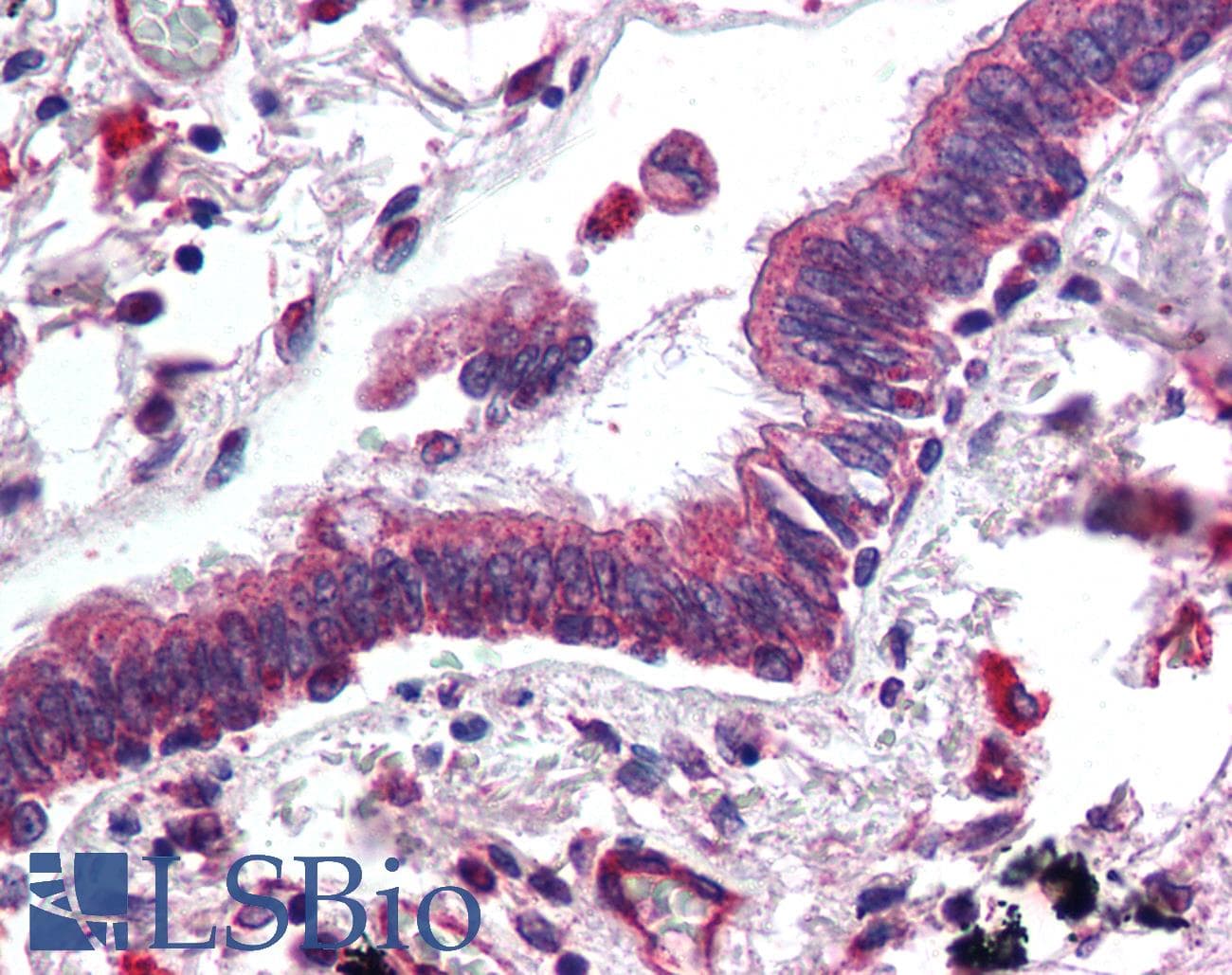 PathPlus™ Polyclonal Goat anti-Human ERBB3 / HER3 Antibody (aa1300-C-term, IHC, IF)
