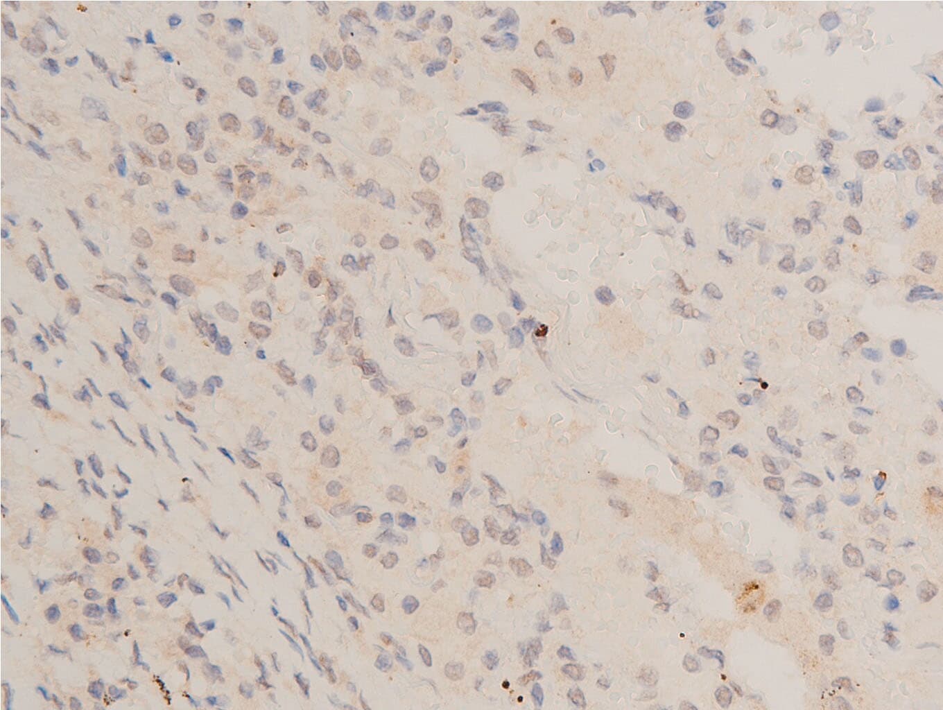 TP53 / p53 Antibody (Acetyl-Lys317)