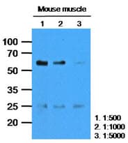 CASQ2 / Calsequestrin 2 Antibody (clone AT4E10)