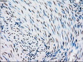 Monoclonal Mouse anti-Human STK3 Antibody (clone OTI2D4, IHC, WB)