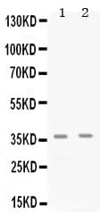 Polyclonal Rabbit anti-Human CDK6 Antibody (WB)