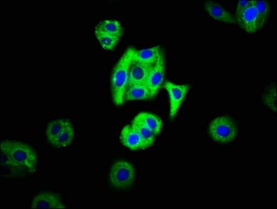 MC3R / MC3 Receptor Antibody