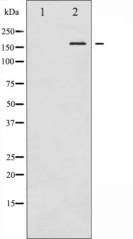 KDR / VEGFR2 / FLK1 Antibody (phospho-Tyr1059)
