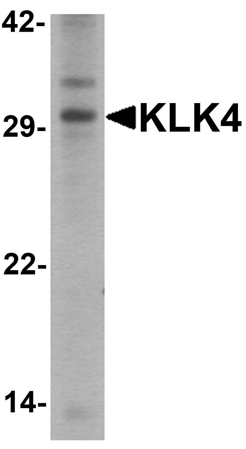 Polyclonal Rabbit anti-Human KLK4 / Kallikrein 4 Antibody (IHC, IF, WB)