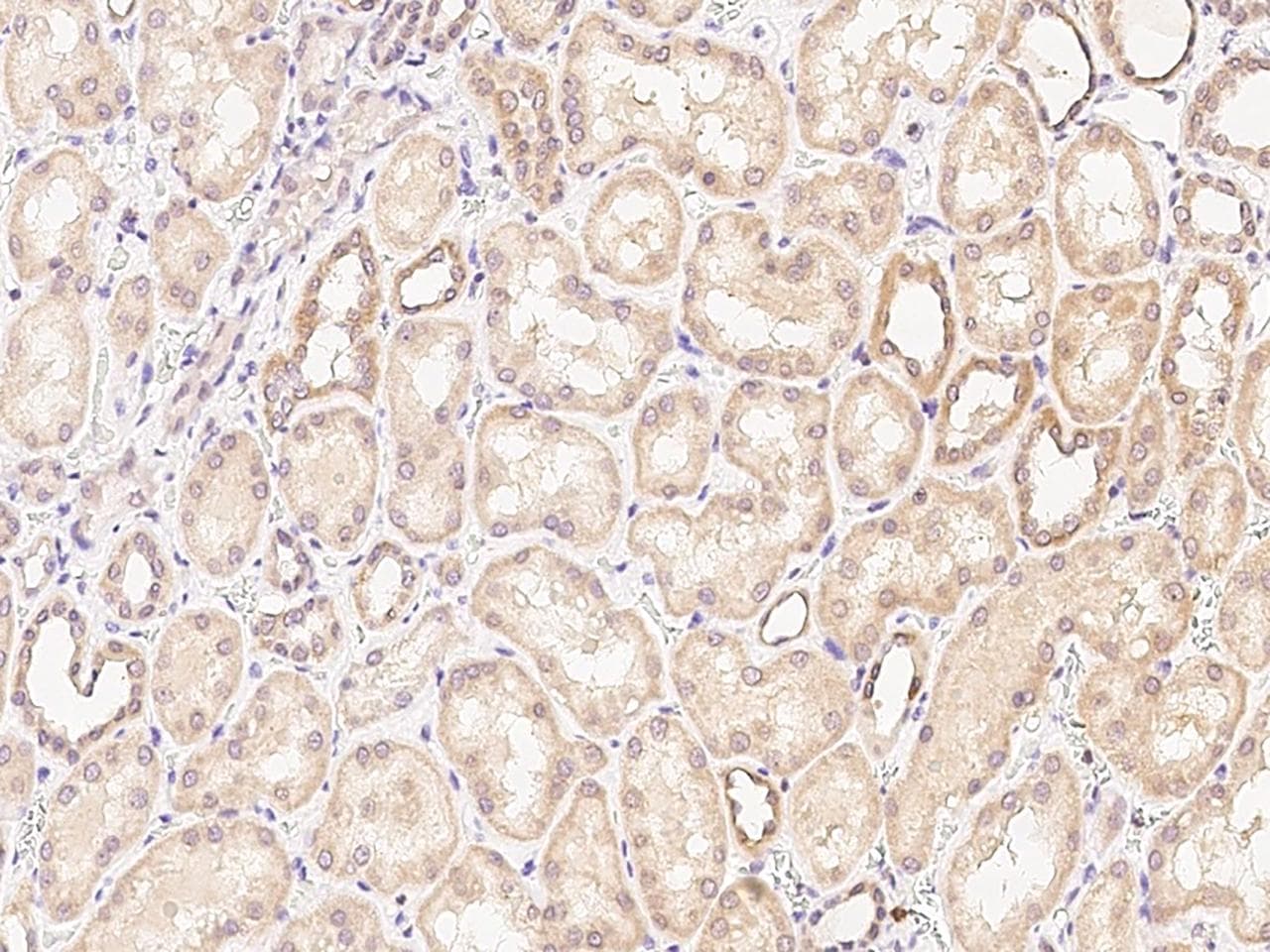 Polyclonal Rabbit anti-Mouse PDGF-D Antibody (Preservative Free, IHC)