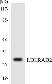LDLRAD2 Antibody (aa112-161)