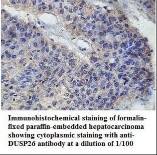 DUSP26 / MKP8 Antibody (aa2-211)