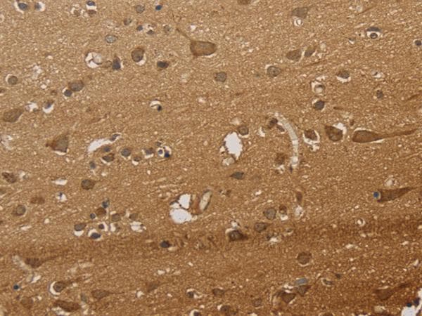 CSNK2B / Phosvitin Antibody