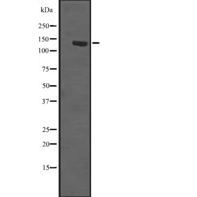 Polyclonal Rabbit anti-Human CC2D1A Antibody (WB)