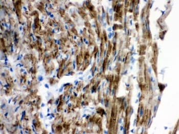 Polyclonal Rabbit anti-Human VDAC1 / PORIN Antibody (aa154-181, IHC, WB)