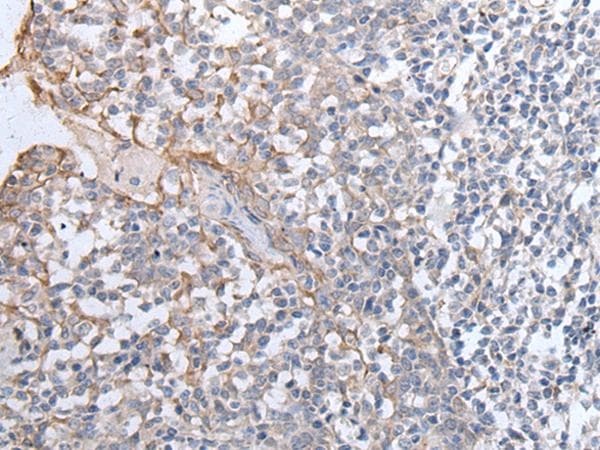 GPD2 Antibody