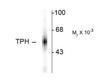 PathPlus™ TPH1 / Tryptophan Hydroxylase Antibody