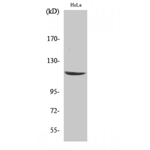 CARD6 Antibody (1-80 aa, N-terminal)