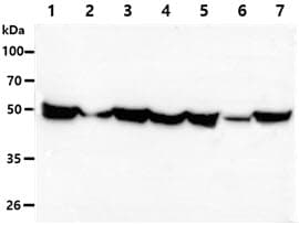 GPI Antibody (clone AT22G2)