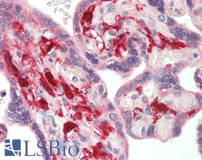 IHC-plus™ PTH / Parathyroid Hormone Antibody