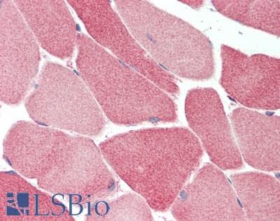 IHC-plus™ Polyclonal Rabbit anti-Human MAP2K5 / MEK5 Antibody (aa1-190, IHC)