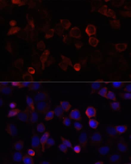 S100A4 / FSP1 Antibody